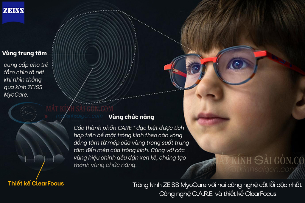 KÍNH KIỂM SOÁT CẬN THỊ ZEISS MYOCARE - Hover